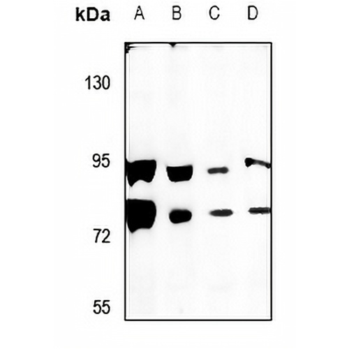 SCML2 Rabbit Polyclonal Antibody