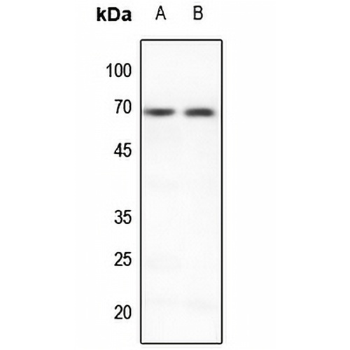 PIAS3 Rabbit Polyclonal Antibody