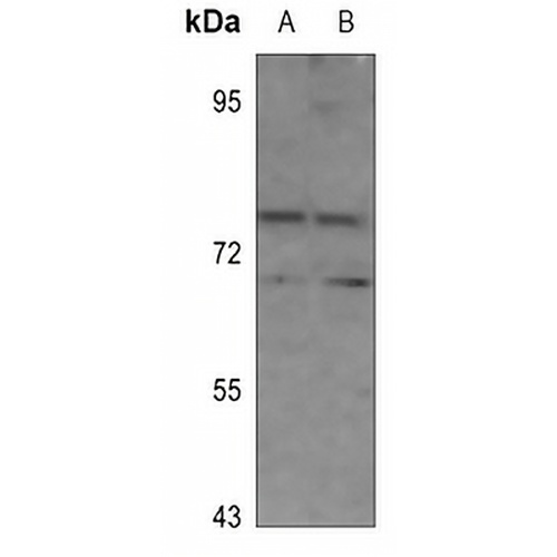 NDC80 Rabbit Polyclonal Antibody