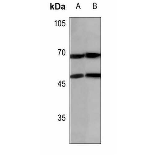 N4BP2L2 Rabbit Polyclonal Antibody