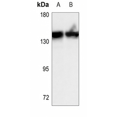 MERTK Rabbit Polyclonal Antibody