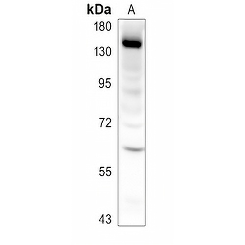 CHERP Rabbit Polyclonal Antibody