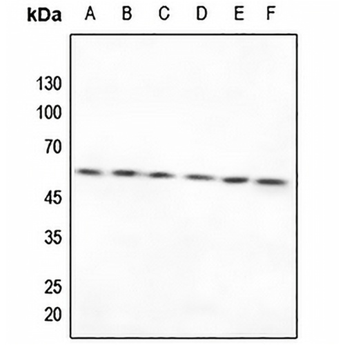 TXNRD2 Rabbit Polyclonal Antibody