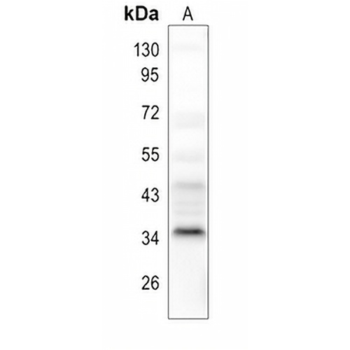 POLR3F Rabbit Polyclonal Antibody