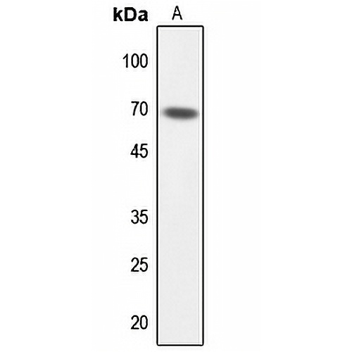 TAF6L Rabbit Polyclonal Antibody