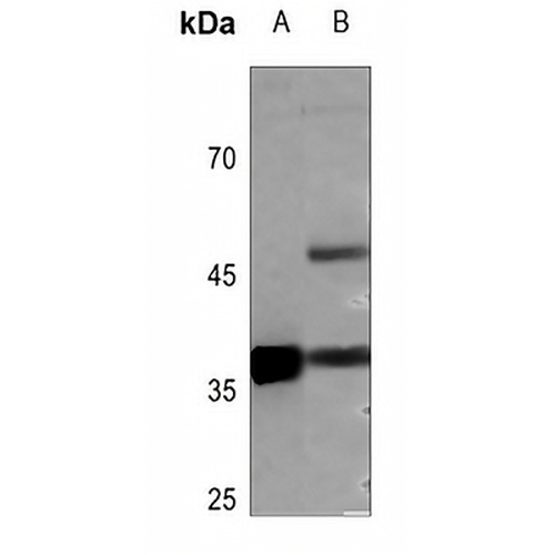 Podoplanin Rabbit Polyclonal Antibody