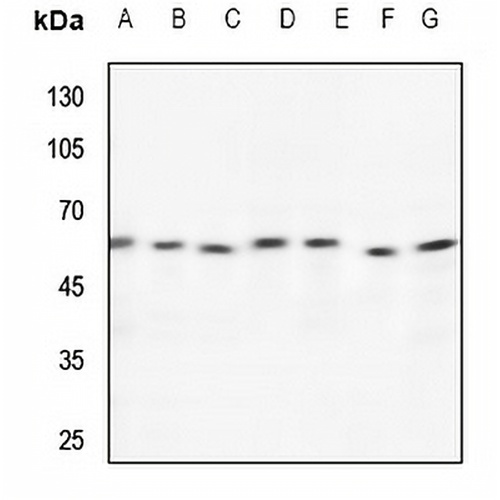 TCP1 theta Rabbit Polyclonal Antibody