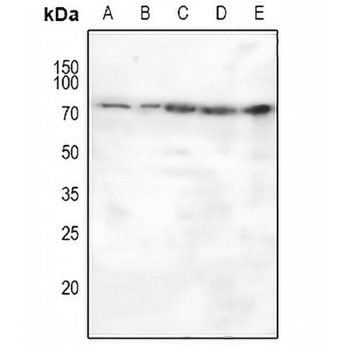 MASP2 Rabbit Polyclonal Antibody