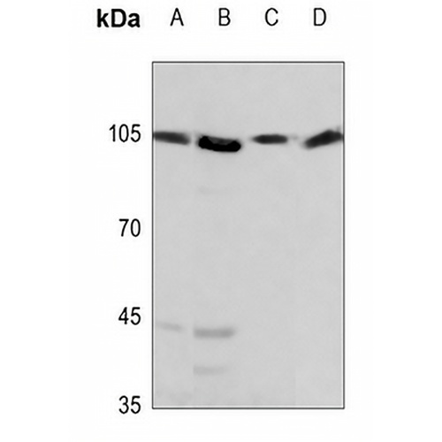 HSPH1 Rabbit Polyclonal Antibody