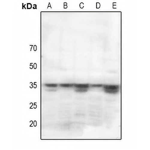 STARD10 Rabbit Polyclonal Antibody