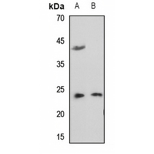 RAB35 Rabbit Polyclonal Antibody