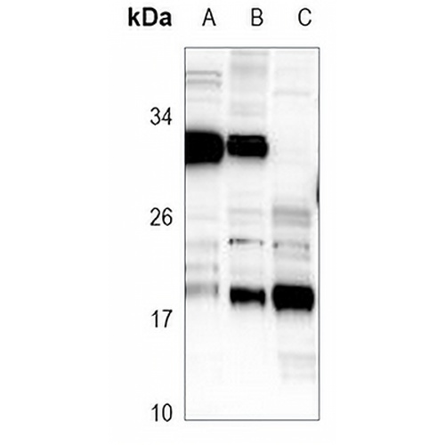 RAB31 Rabbit Polyclonal Antibody
