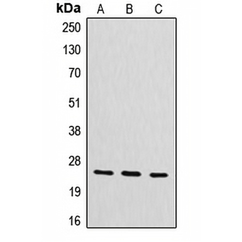 CYB561D2 Rabbit Polyclonal Antibody