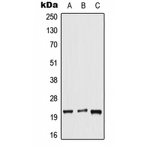 DUSP14 Rabbit Polyclonal Antibody