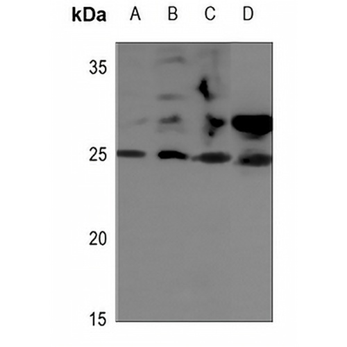 STMN2 Rabbit Polyclonal Antibody