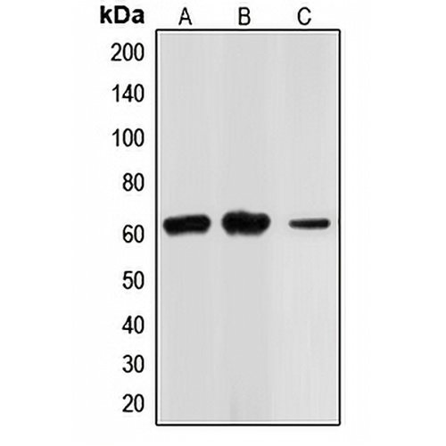 CHK2 Rabbit Polyclonal Antibody
