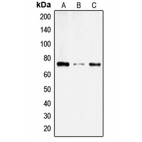 SLC6A14 Rabbit Polyclonal Antibody