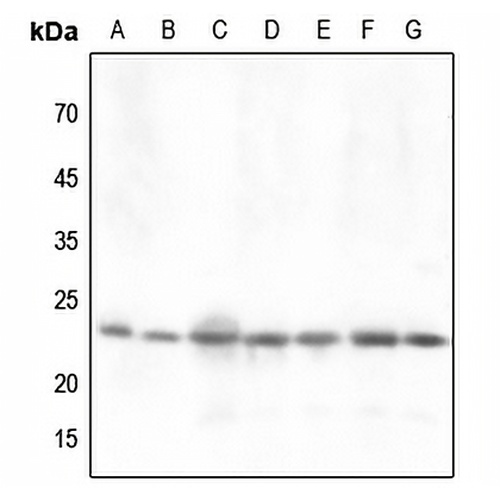 DJ-1 Rabbit Polyclonal Antibody