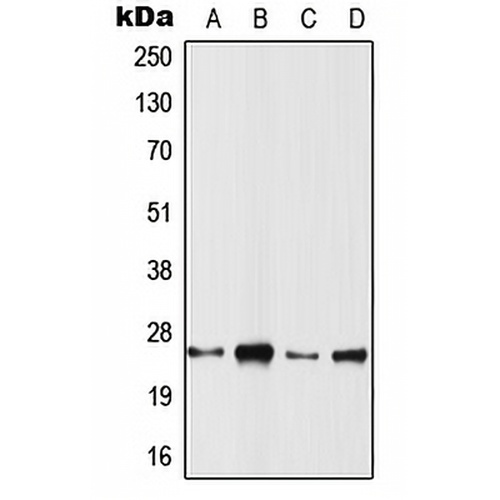 RRAS2 Rabbit Polyclonal Antibody