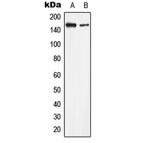 LMTK2 Rabbit Polyclonal Antibody