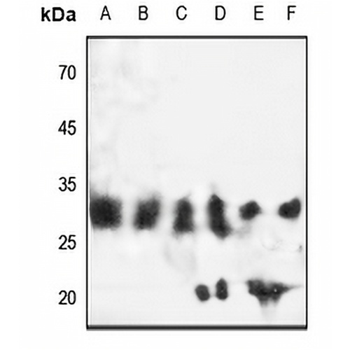 EB3 Rabbit Polyclonal Antibody