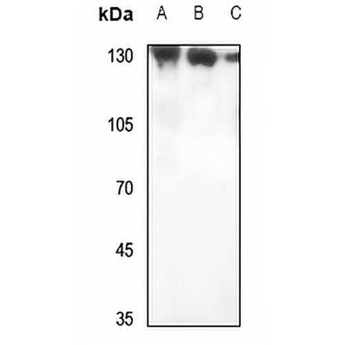 RAB3GAP1 Rabbit Polyclonal Antibody