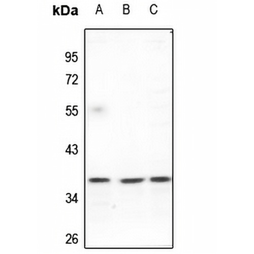 FAIM2 Rabbit Polyclonal Antibody