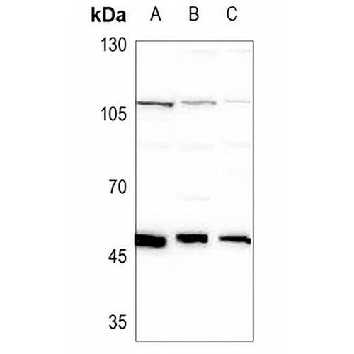 RBM34 Rabbit Polyclonal Antibody