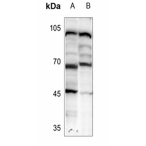 HIC2 Rabbit Polyclonal Antibody