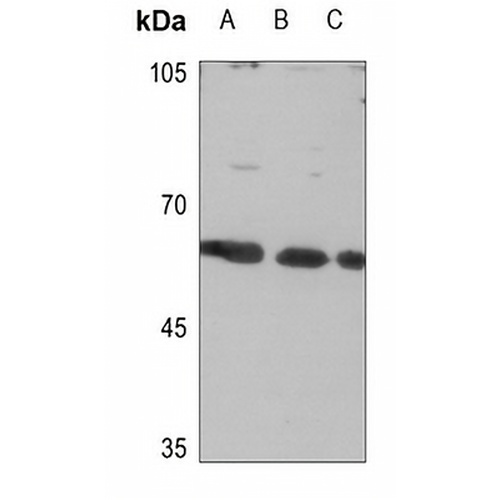 CLCC1 Rabbit Polyclonal Antibody