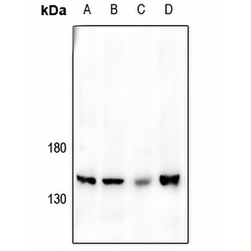 JIP3 Rabbit Polyclonal Antibody