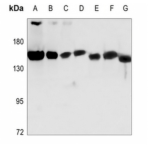NUP160 Rabbit Polyclonal Antibody