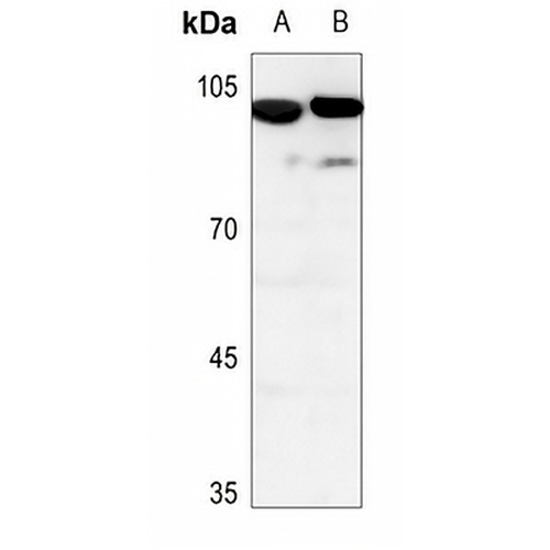 PIP5K1C Rabbit Polyclonal Antibody