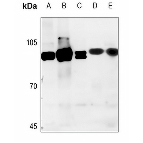 NCAPH Rabbit Polyclonal Antibody