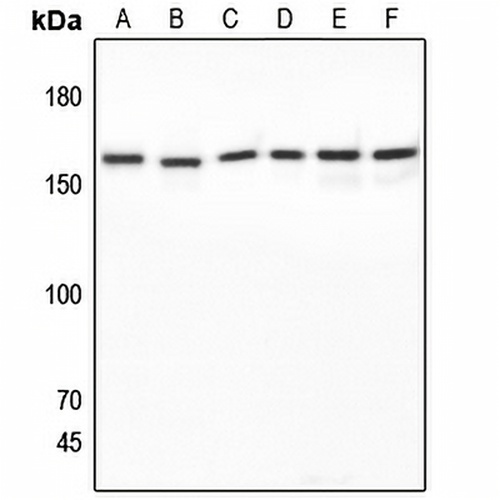 SAP155 Rabbit Polyclonal Antibody