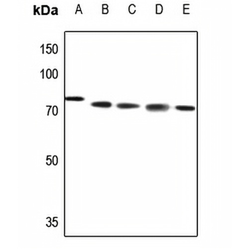 ABCB10 Rabbit Polyclonal Antibody