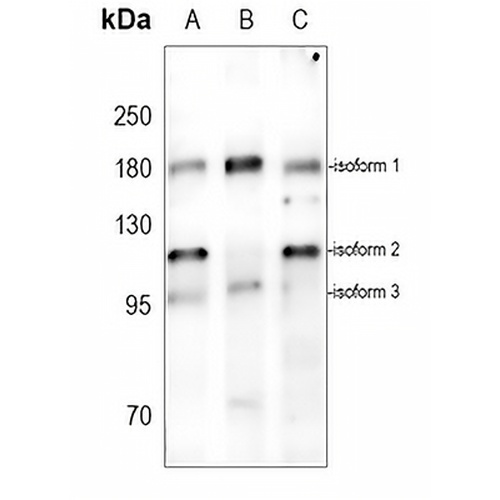 ABCA5 Rabbit Polyclonal Antibody