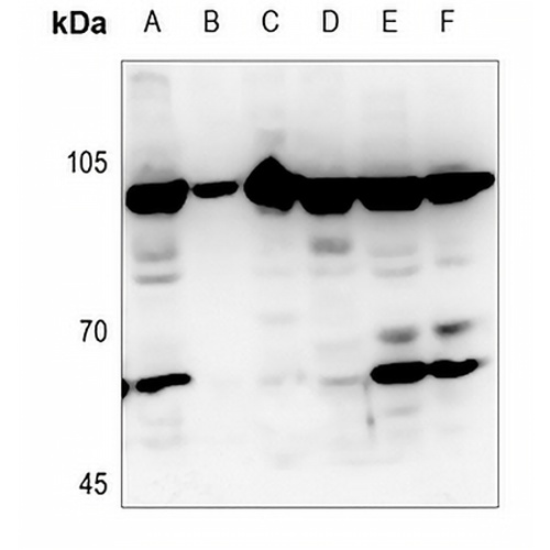 JIP2 Rabbit Polyclonal Antibody