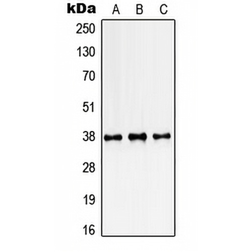 SSBP2 Rabbit Polyclonal Antibody