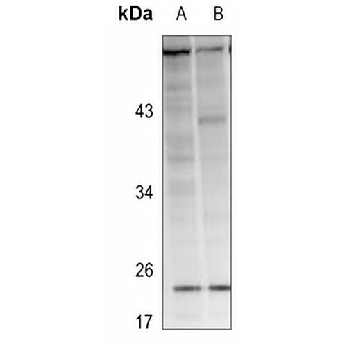 RAB38 Rabbit Polyclonal Antibody