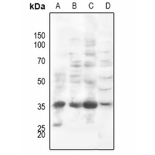 PI-TP beta Rabbit Polyclonal Antibody
