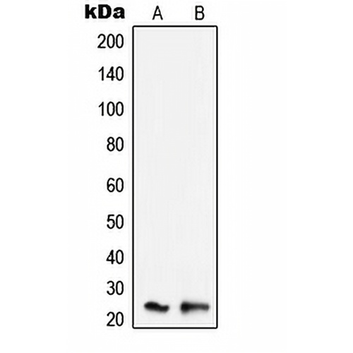 SCC-S2 Rabbit Polyclonal Antibody