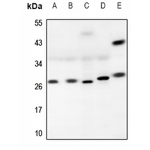 RAB26 Rabbit Polyclonal Antibody