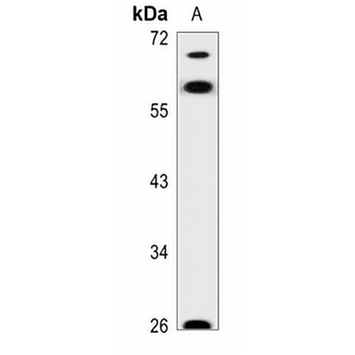 AATF Rabbit Polyclonal Antibody