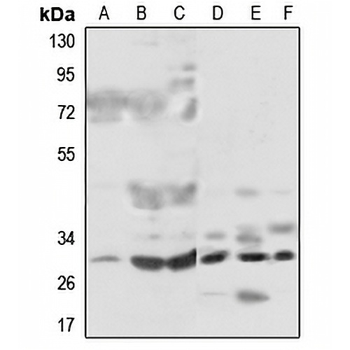 MRPL46 Rabbit Polyclonal Antibody