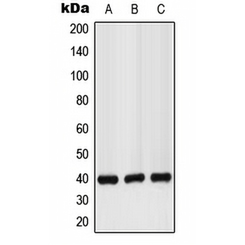 GPR160 Rabbit Polyclonal Antibody