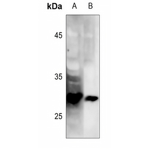 LAT (Phospho-Y191) Rabbit Polyclonal Antibody