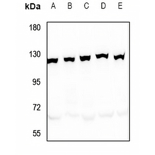 SND1 Rabbit Polyclonal Antibody
