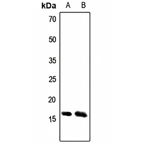 ATP5S Rabbit Polyclonal Antibody