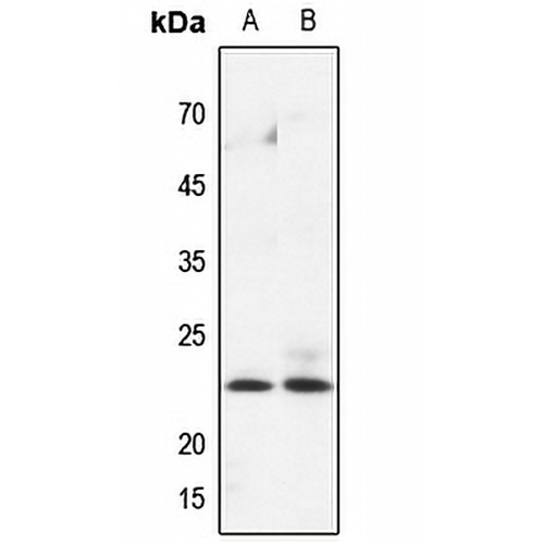 HPGDS Rabbit Polyclonal Antibody